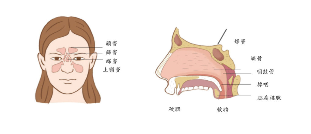 鼻竇炎